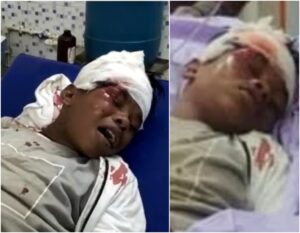 Sahdev Dirdo Road Accident